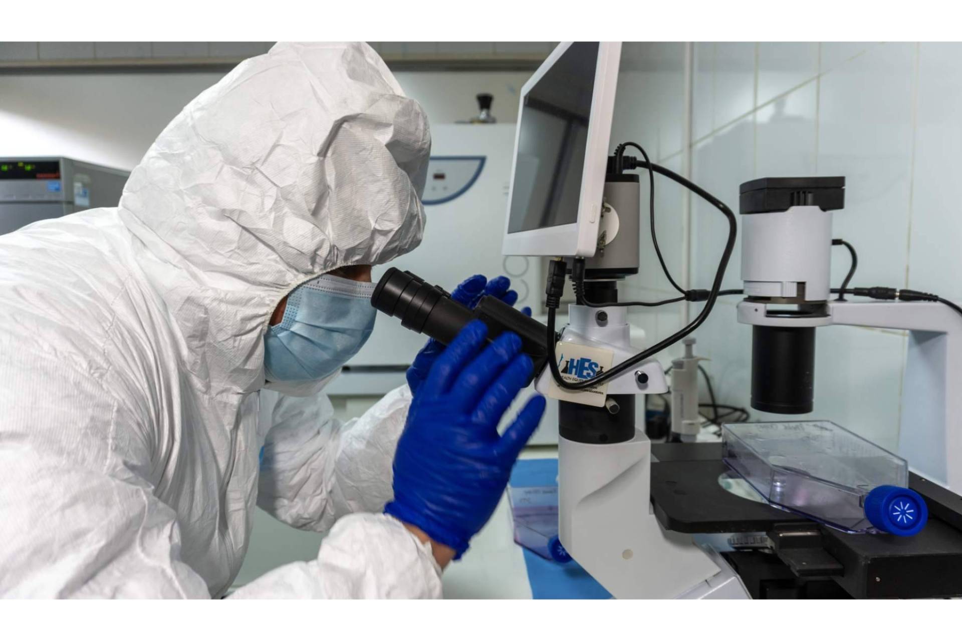 Cancer avanzado; El valioso aporte actual de la inmunoterapia DEX en el tratamiento personalizado del cáncer