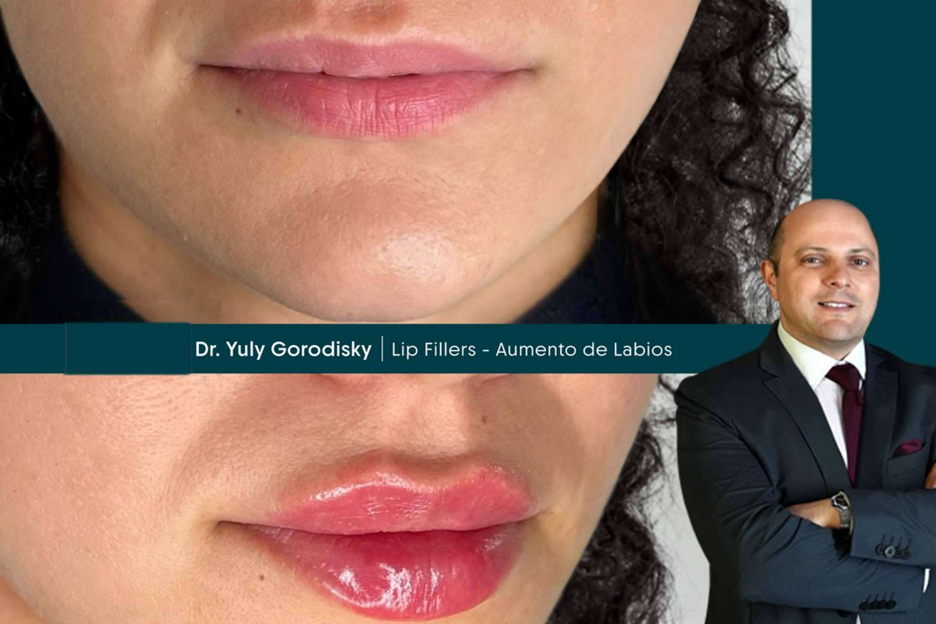 Top Celebrity Plastic Surgeon Brings Beverly Hills Beauty to Miami